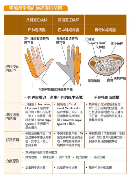 右手拇指|手麻很久、大拇指麻，是腕隧道症候群症狀嗎？手麻怎麼辦？醫師。